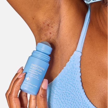 The Ingrown Roller