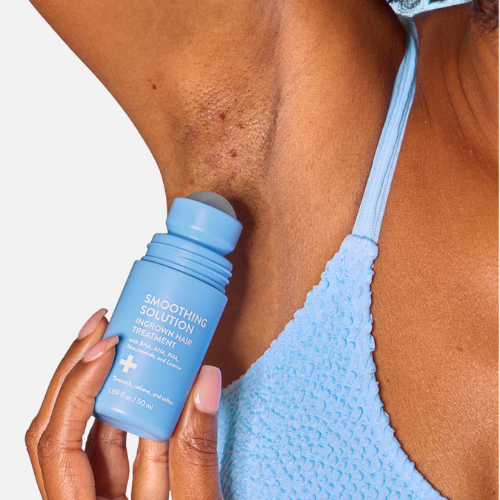The Ingrown Roller